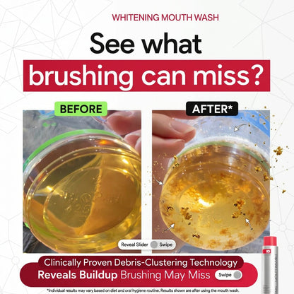Swishi Stain Whitening Mouthwash
